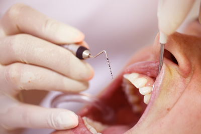 Nærbilde av tannrenseutstyr som skal inn i munn.